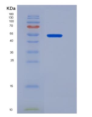 Recombinant Human SIRP alpha protein,Recombinant Human SIRP alpha protein