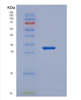 Human Tumor necrosis factor receptor superfamily member 17 Protein,Human Tumor necrosis factor receptor superfamily member 17 Protein