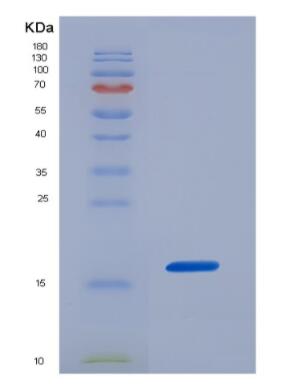 Recombinant CPj0308 protein(TrEMBL),Recombinant CPj0308 protein(TrEMBL)