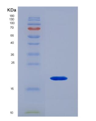 Recombinant Human SFTPD Protein,Recombinant Human SFTPD Protein