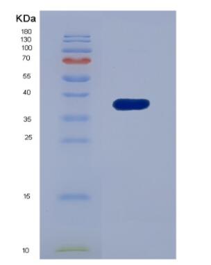 Recombinant Interferon Inducible Protein 35 (IFI35),Recombinant Interferon Inducible Protein 35 (IFI35)
