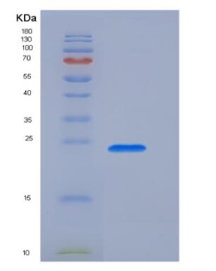 Recombinant Human Transient Receptor Potential Cation Channel Subfamily V, Member 1 (TRPV1) Protein,Recombinant Human Transient Receptor Potential Cation Channel Subfamily V, Member 1 (TRPV1) Protein