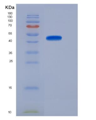 Recombinant rat FGF10 protein,Recombinant rat FGF10 protein