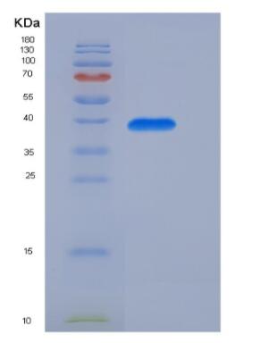 Recombinant Insulin (INS) protein,Recombinant Insulin (INS) protein