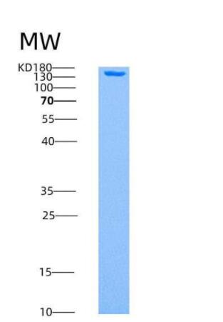 Recombinant Human AMPK (G1/B1/A1) Heterotrimer Protein,Recombinant Human AMPK (G1/B1/A1) Heterotrimer Protein