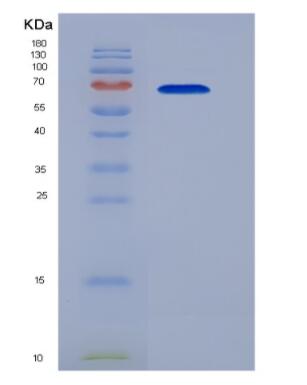 Recombinant Mouse Heat Shock 70kDa Protein 1B (HSPA1B),Recombinant Mouse Heat Shock 70kDa Protein 1B (HSPA1B)