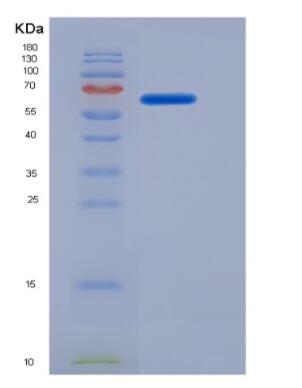 Recombinant Monoamine Oxidase A (MAOA),Recombinant Monoamine Oxidase A (MAOA)