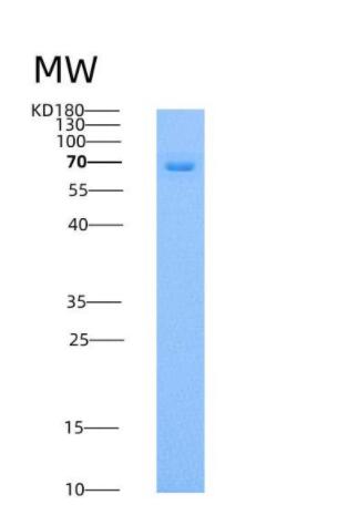 Recombinant Human Coagulation Factor XI / FXI / F11 Protein (His tag),Recombinant Human Coagulation Factor XI / FXI / F11 Protein (His tag)