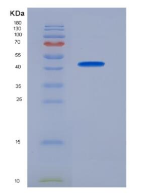 Recombinant Sodium/Glucose Cotransporter 2 (SGLT2),Recombinant Sodium/Glucose Cotransporter 2 (SGLT2)