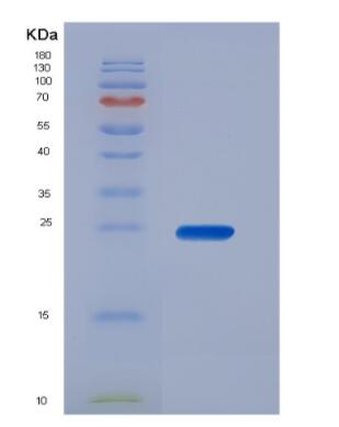 Recombinant Carcinoembryonic Antigen (CEA),Recombinant Carcinoembryonic Antigen (CEA)