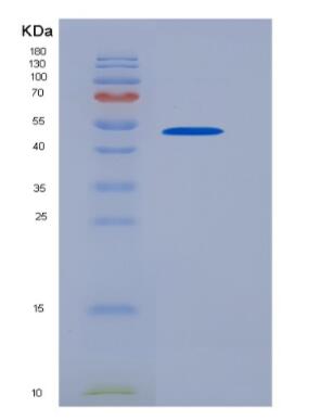 Recombinant Human CD83 protein,Recombinant Human CD83 protein