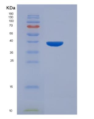 Recombinant Human Serotonin Transporter (SERT) Protein,Recombinant Human Serotonin Transporter (SERT) Protein