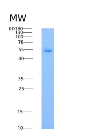 Recombinant Human DOPA Decarboxylase / DDC Protein (His tag),Recombinant Human DOPA Decarboxylase / DDC Protein (His tag)