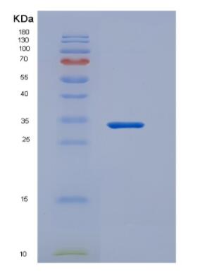 Recombinant Rat TNFRSF17 / BCMA Protein (Fc tag),Recombinant Rat TNFRSF17 / BCMA Protein (Fc tag)