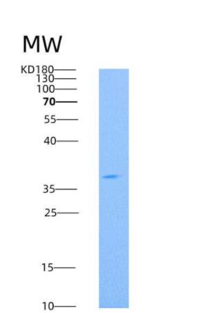 Recombinant Human CD73 / NT5E Protein (His tag),Recombinant Human CD73 / NT5E Protein (His tag)