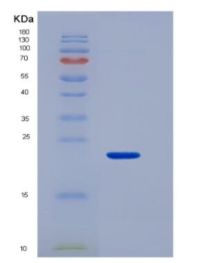 Recombinant Mucin 4 (MUC4),Recombinant Mucin 4 (MUC4)