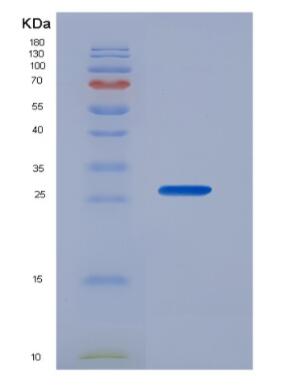 Recombinant Cyclin B (CCNB),Recombinant Cyclin B (CCNB)