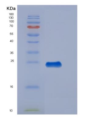 Recombinant Human Thrombomodulin (TM) Protein,Recombinant Human Thrombomodulin (TM) Protein