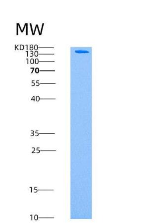 Recombinant Human AMPK (G1/B2/A1) Heterotrimer Protein,Recombinant Human AMPK (G1/B2/A1) Heterotrimer Protein