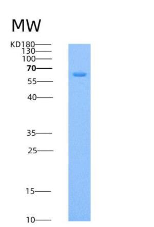 Recombinant Mouse Endoglin / CD105 / ENG Protein (His tag),Recombinant Mouse Endoglin / CD105 / ENG Protein (His tag)