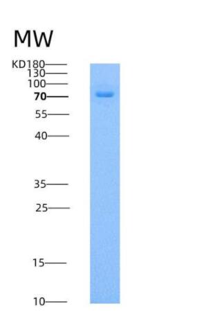 Recombinant Human ILT6 / LILRA3 Protein (Fc tag),Recombinant Human ILT6 / LILRA3 Protein (Fc tag)