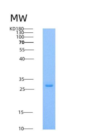 Recombinant Human respiratory syncytial virus (RSV) (A, rsb1734) glycoprotein G / RSV-G Protein (93% Homology) (His Tag),Recombinant Human respiratory syncytial virus (RSV) (A, rsb1734) glycoprotein G / RSV-G Protein (93% Homology) (His Tag)