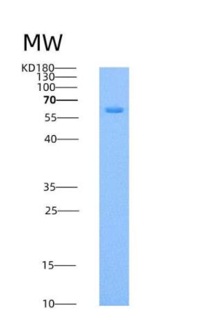 Recombinant Human HPRG / HRG Protein (His tag),Recombinant Human HPRG / HRG Protein (His tag)