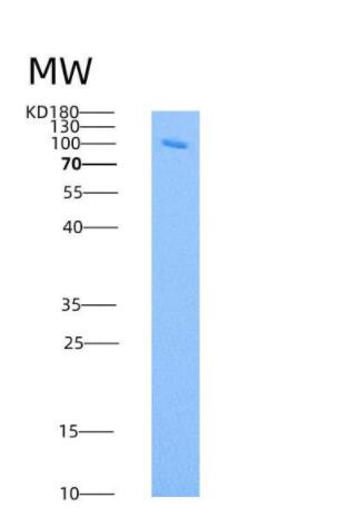 Recombinant Human ANPEP / CD13 Protein (603 Met/Ile, His tag),Recombinant Human ANPEP / CD13 Protein (603 Met/Ile, His tag)
