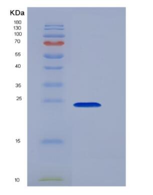 Recombinant Pig Interleukin 6 (IL6) protein,Recombinant Pig Interleukin 6 (IL6) protein