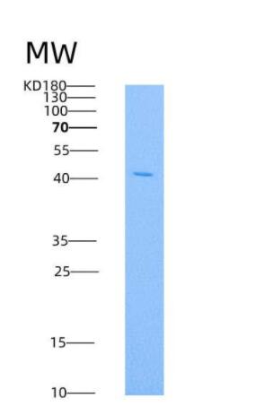 Recombinant Mouse HVEM / TNFRSF14 Protein (His & Fc tag),Recombinant Mouse HVEM / TNFRSF14 Protein (His & Fc tag)