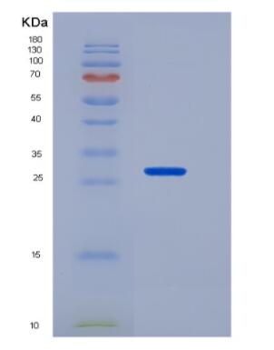 Recombinant Tumor Necrosis Factor Receptor Superfamily, Member 17 (TNFRSF17),Recombinant Tumor Necrosis Factor Receptor Superfamily, Member 17 (TNFRSF17)