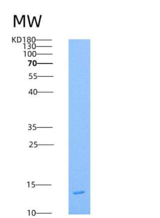 Recombinant Human PDGF-B Protein (His Tag),Recombinant Human PDGF-B Protein (His Tag)