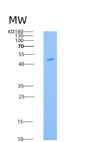 Recombinant Mouse Legumain Protein (His Tag),Recombinant Mouse Legumain Protein (His Tag)