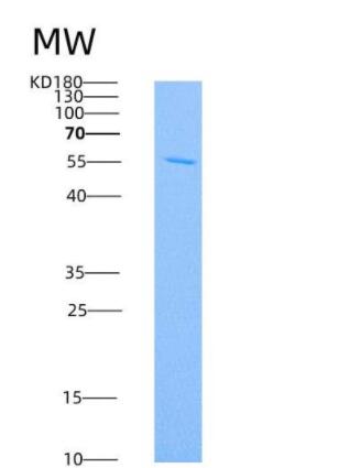 Recombinant Human DCR3 / TNFRSF6B Protein (Fc tag),Recombinant Human DCR3 / TNFRSF6B Protein (Fc tag)