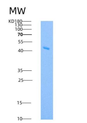 Recombinant Human IDO1 / IDO Protein,Recombinant Human IDO1 / IDO Protein