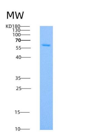 Recombinant Human SMPD1 / ASM Protein (His tag),Recombinant Human SMPD1 / ASM Protein (His tag)