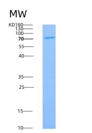 Recombinant Rat CD36 / SCARB3 Protein (Fc tag),Recombinant Rat CD36 / SCARB3 Protein (Fc tag)