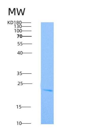 Recombinant Rat TNFRSF11A Protein (His tag),Recombinant Rat TNFRSF11A Protein (His tag)