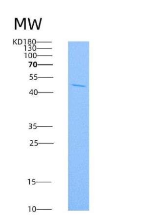 Recombinant Rat IL4R / Il4ra Protein (Fc tag),Recombinant Rat IL4R / Il4ra Protein (Fc tag)