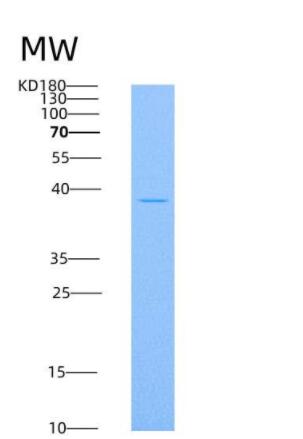 Recombinant Mouse sFRP4 Protein (His tag),Recombinant Mouse sFRP4 Protein (His tag)