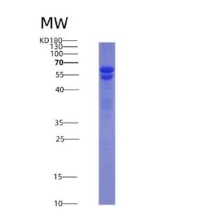 Recombinant Nuclear Mitotic Apparatus Protein 1 (NUMA1)