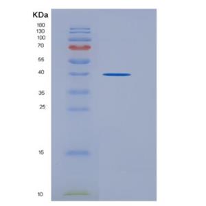 Recombinant Mouse Wingless Type MMTV Integration Site Family, Member 5A (WNT5A) Protein,Recombinant Mouse Wingless Type MMTV Integration Site Family, Member 5A (WNT5A) Protein