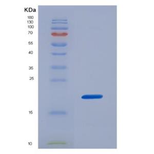 Recombinant Mouse Interleukin 17B (IL17B),Recombinant Mouse Interleukin 17B (IL17B)