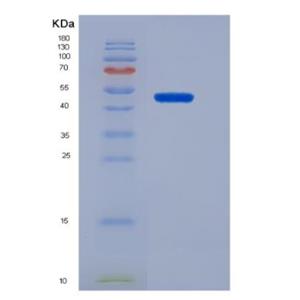 Recombinant Mdm2 p53 Binding Protein Homolog (MDM2)