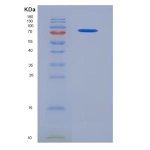 Recombinant Colony Stimulating Factor 1, Macrophage (MCSF)