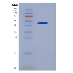 Recombinant Bcl2/Adenovirus E1B 19kDa Interacting Protein 3 (BNIP3)