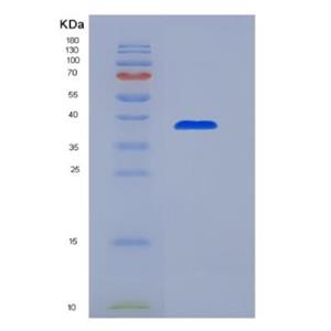 Recombinant Glucocorticoid Receptor (GR),Recombinant Glucocorticoid Receptor (GR)