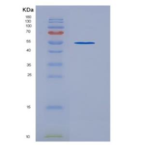 Recombinant Human TIE2 protein,Recombinant Human TIE2 protein