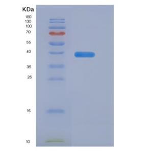 Recombinant Human Syncollin (SYCN) protein,Recombinant Human Syncollin (SYCN) protein