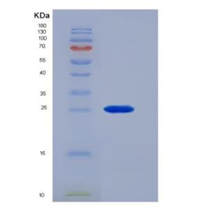 Recombinant Mouse Colony Stimulating Factor Receptor, Macrophage (MCSFR) Protein,Recombinant Mouse Colony Stimulating Factor Receptor, Macrophage (MCSFR) Protein